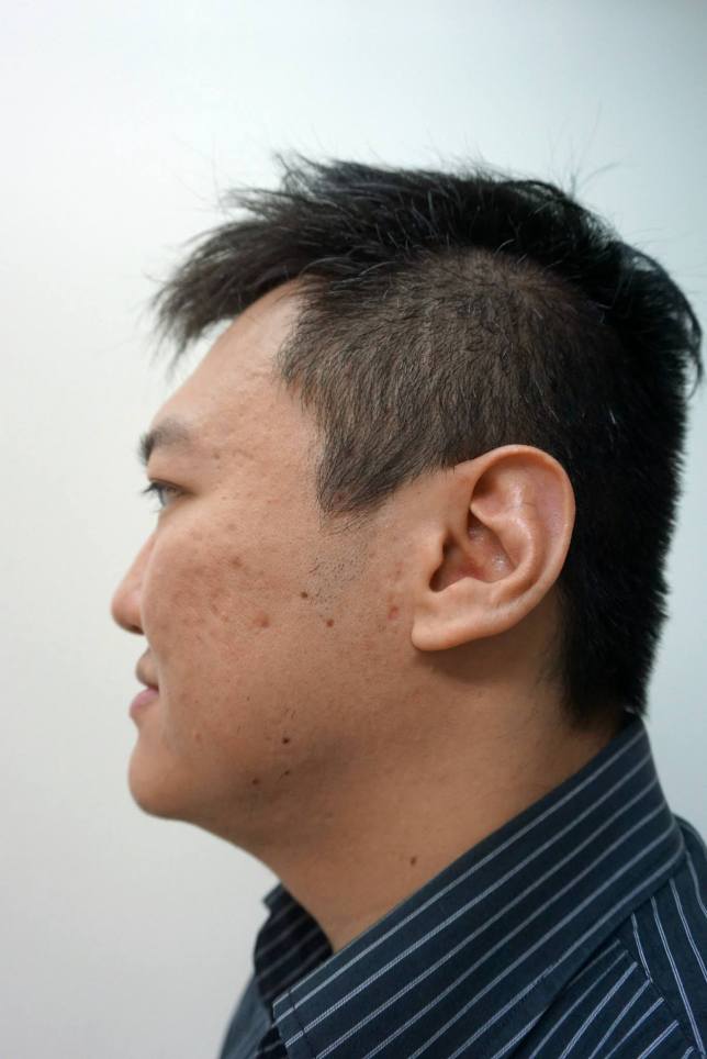 Here's a look from the side