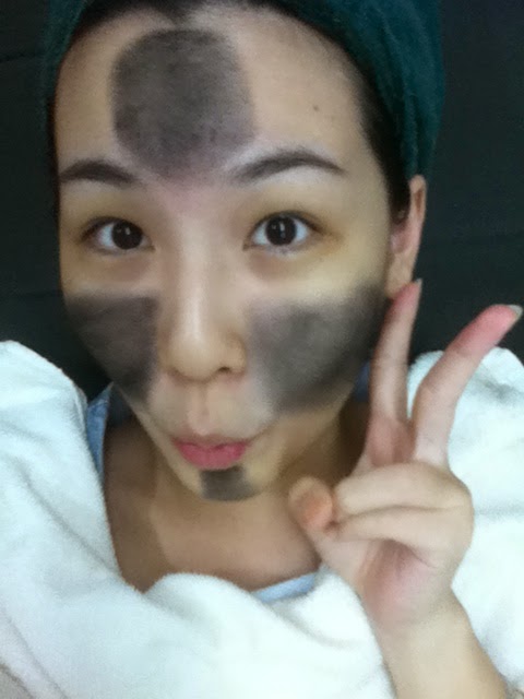 Carbon Blast Treatment