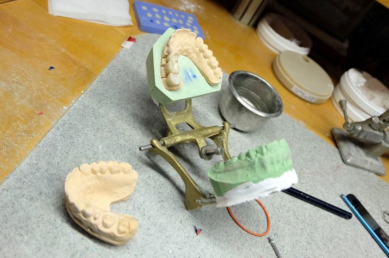 Everything is done in house by the technicians cutting down on the time you need to wait for implants, etc. etc.